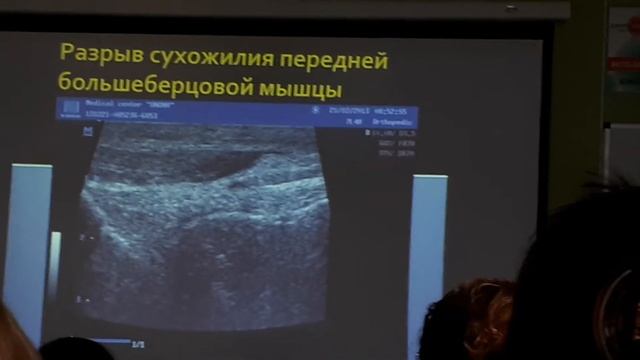 Голеностоп 28 смотреть онлайн