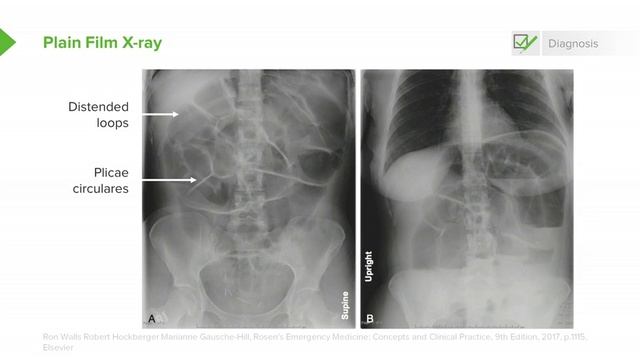 4.05 SBO- Examination & Diagnosis смотреть онлайн