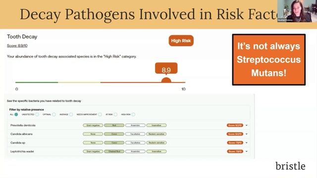 Webinar: Now What? Treatment Planning with Salivary Testing смотреть онлайн