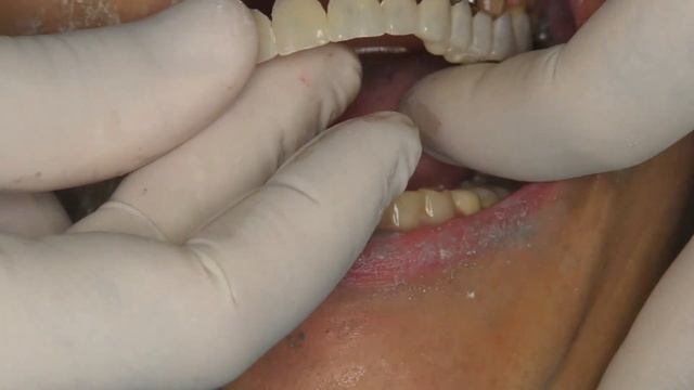 Dr. Elie ZEBOUNI: The Golden Rule of Proportion in Anterior Esthetics: Myth or Reality? смотреть онлайн