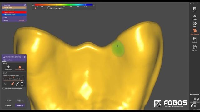 ExoCad_Fobos_connect (индивидуальная ложка)