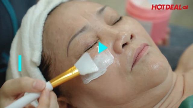 Trị Nám CN Laser Ultra Helios Tại Thẩm Mỹ Viện Shiny Beauty Center | Hotdeal Hà Nội смотреть онлайн