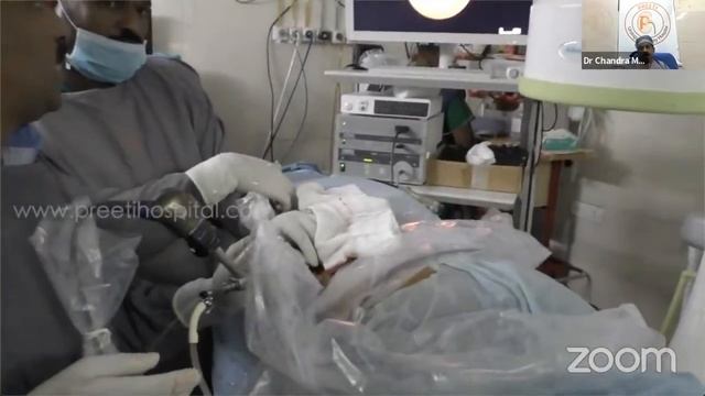 Prone PCNL - Supra Costal Puncture смотреть онлайн