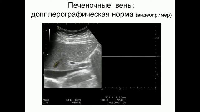 Нет в основном 1216 2 смотреть онлайн