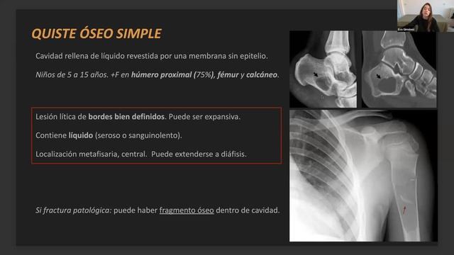 533- Lesiones óseas que no hay que tocar. Curso de Radiologia Esencial смотреть онлайн