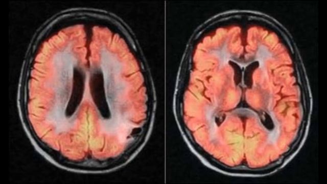X-rays.wmv смотреть онлайн