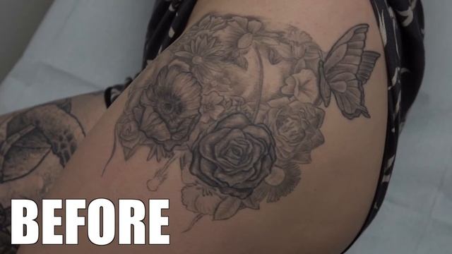 Laser Tattoo Removal With the Picosure смотреть онлайн