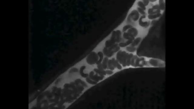 In vivo imaging of adipose tissue смотреть онлайн