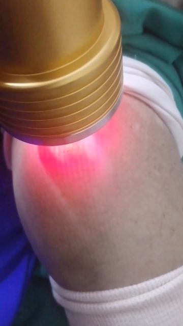 Laser therapy for knee Pain ✨ #shorts #ytshorts #viral #trending #acuhealingwithdraqsa смотреть онлайн