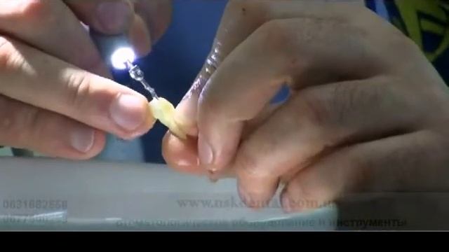 Скалер, Woodpecker, UDS-L LED  часть 2