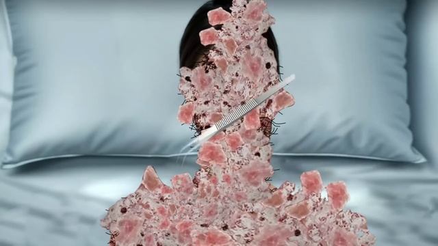 asmr 3d animation Injured face Therapy смотреть онлайн