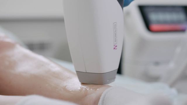 Лазерная эпиляция в медицинском центре "ГАРМОНИЯ" г. Жодино смотреть онлайн