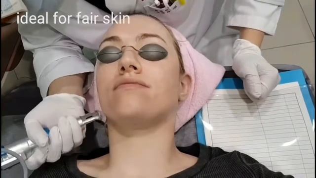 Acne Scars Laser Treatment: Remove Dark Spots, Moles, and more! | Clear Skin Procedure смотреть онлайн