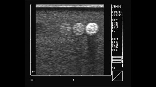 Siemens SL-1 - 4483277 LH209 7.5MHZ - głowica USG смотреть онлайн