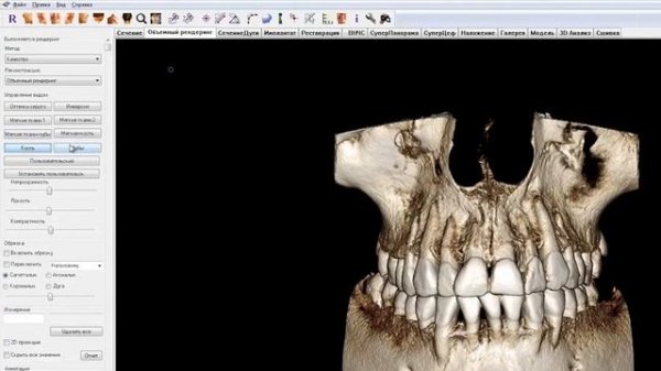 Базовые навыки работы в программе InVivo™ 5 3 KaVo