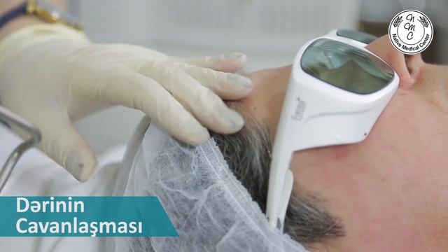 Dərinin cavanlaşması смотреть онлайн