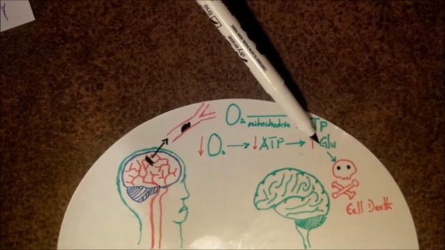 stroke смотреть онлайн
