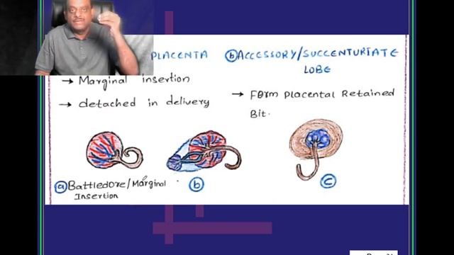 9 pm 29 Jan NEET PG AIIMS FMGE MBBS Prof GOB Anatomy Revision Subscribe www.onlinembbs.com смотреть онлайн