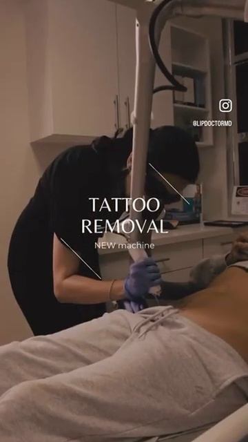 🌟 Transform Your Skin at Lip Doctor: Discover Pico Tattoo Removal Today! 🌟 смотреть онлайн