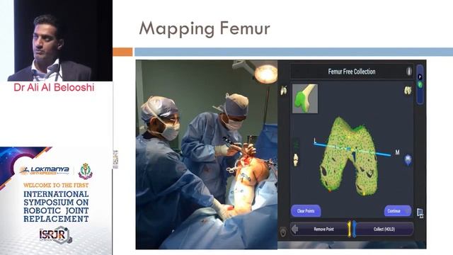 Efficiency in the OR with Robotics By Dr. All Belooshi смотреть онлайн