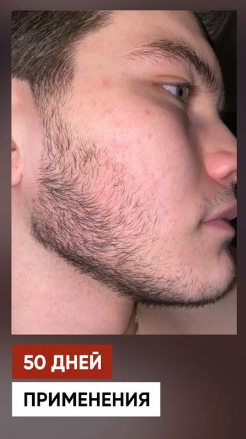 ЗАРАСТИЛ ЩЕКИ С ПОМОЩЬЮ КИРКЛАНД смотреть онлайн