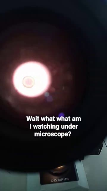 Ascaris Lumbricoides, fertilized egg under microscope смотреть онлайн