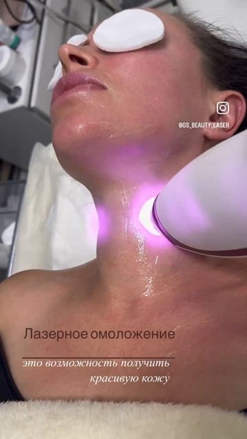 Лазерное омоложения на премиальном лазере Ruikd Lamis смотреть онлайн