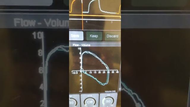 Ventilation, third session, example of graphics and loops смотреть онлайн