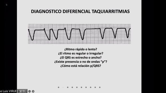 4. cardio, taquicardias y bradicardias смотреть онлайн