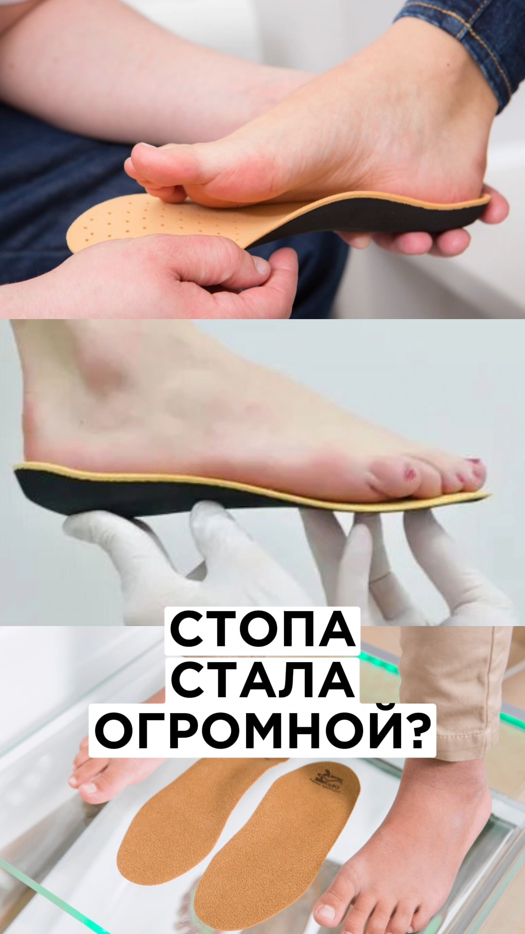 Если у вас Стопа стала большая, какие стельки вам нужны и для чего? #плоскостопие #стельки смотреть онлайн