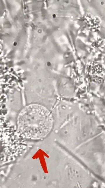 checking Apple by microscope 99 #microscope #shorts #video #like #subscribe смотреть онлайн