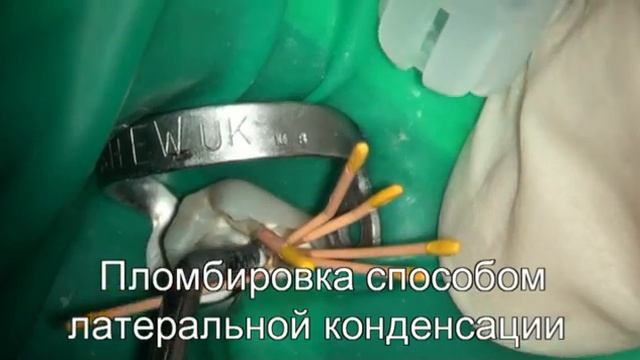 Вкв смотреть онлайн