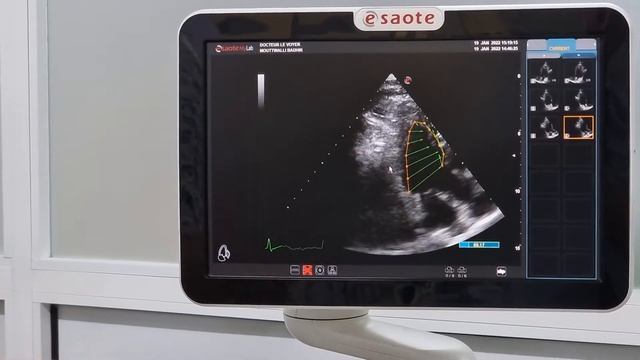 Bulls eye siemens ge esaote samsung смотреть онлайн