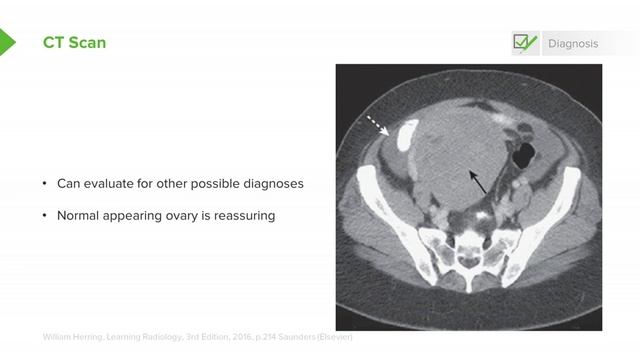 3.11 Ovarian Torsion- Examination & Management смотреть онлайн