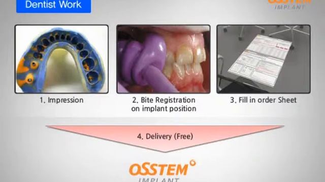 Smartfit_CAD CAM Abutment смотреть онлайн