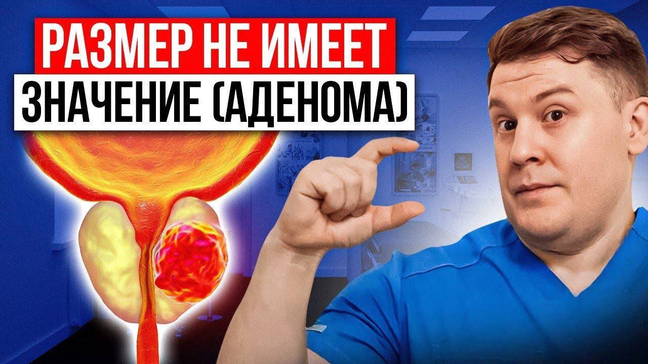 ЭТИ 4 ОБСЛЕДОВАНИЯ ПОМОГУТ С ЛЕЧЕНИЕМ АДЕНОМЫ смотреть онлайн