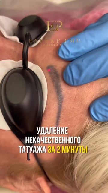 Удалим некачественный татуаж за 2 МИНУТЫ🔥#обучениелазерномуудалению #лазерноеудаление #удаление смотреть онлайн