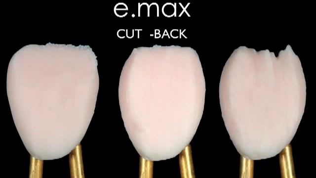 IPS E.max ceram porcelain Build up смотреть онлайн