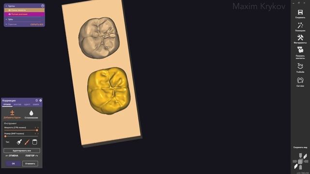 Exocad Carving I Tooth Modeling 2