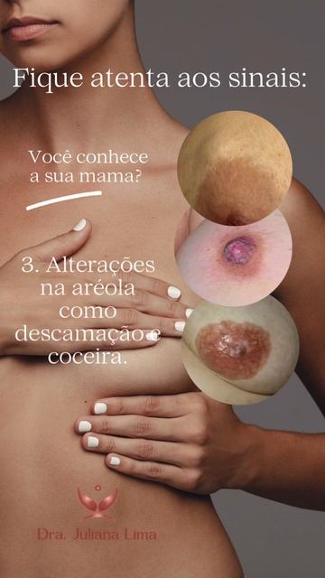 Você conhece a sua mama? Fique atenta aos sinais de doenças da mama! смотреть онлайн