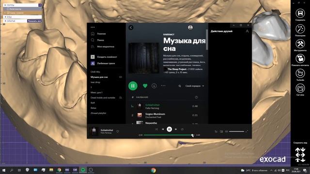 ExoCad моделирование, с 5 по 5 Emax смотреть онлайн