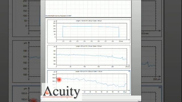 Medical Stent 2D and 3D Surface Scan смотреть онлайн