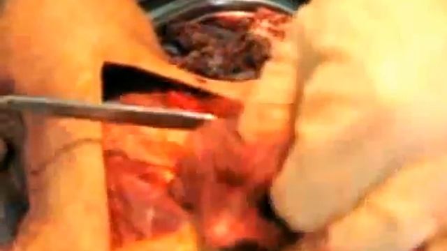 Techniques Autopsy - video Tutorial смотреть онлайн