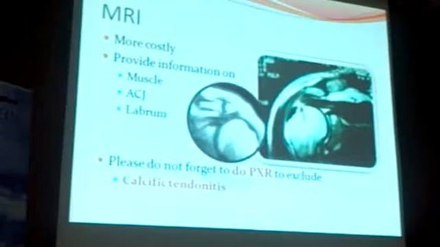Rotator Cuff Tear Prof Dr Mohammad Sobhy смотреть онлайн