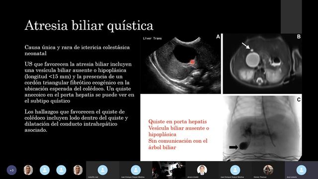 Hígado lesiones quísticas en Pediatría смотреть онлайн