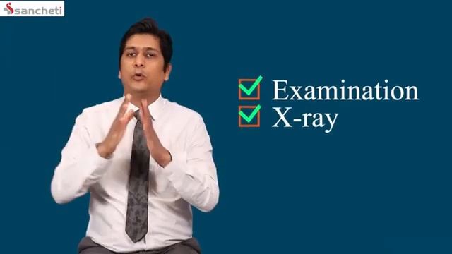 What is Lumbar spine spondylolisthesis: Explained in a very simple way смотреть онлайн