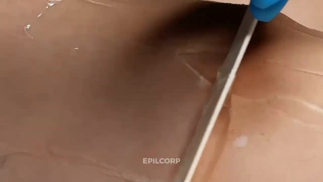 Лазерная эпиляция смотреть онлайн