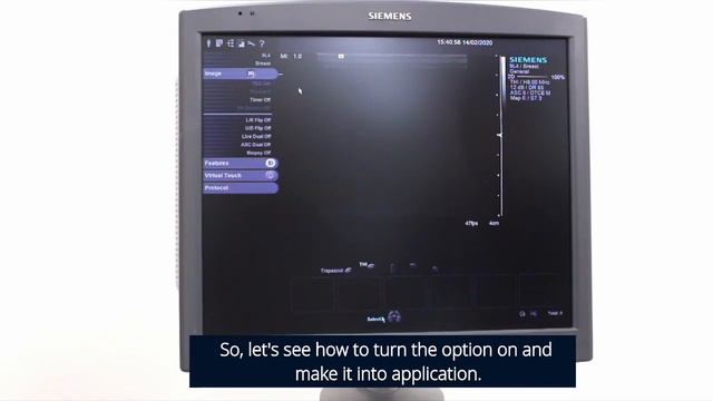 Siemens S2000 - How to Turn on the eSie Touch Elasticity Imaging Option? смотреть онлайн