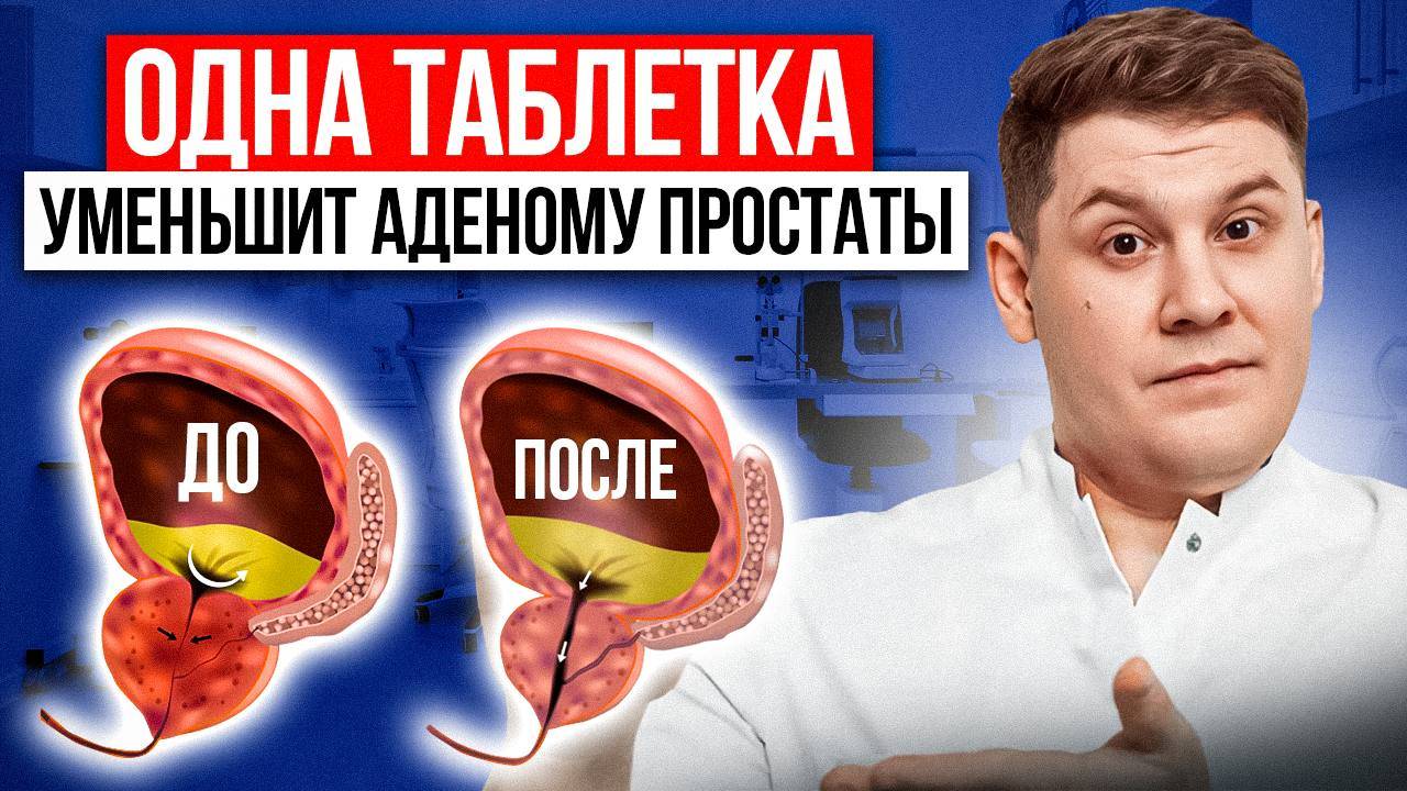 Одна таблетка уменьшит простату или как избежать операцию по удалению аденомы смотреть онлайн