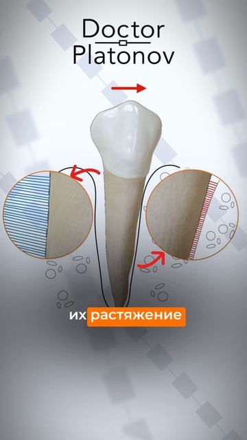 КАК БРЕКЕТЫ ДВИГАЮТ ЗУБЫ смотреть онлайн